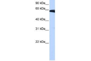 WB Suggested Anti-PIGW Antibody Titration:  0. (PIGW 抗体  (Middle Region))