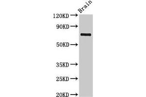 Western Blot Positive WB detected in: Rat brain tissue All lanes: L3MBTL4 antibody at 3 μg/mL Secondary Goat polyclonal to rabbit IgG at 1/50000 dilution Predicted band size: 72, 62 kDa Observed band size: 72 kDa (L3MBTL4 抗体  (AA 1-270))