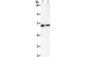Gel: 10 % SDS-PAGE, Lysate: 40 μg, Lane 1-2: Human liver cancer tissue, 293T cells, Primary antibody: ABIN7192602(SOX1 Antibody) at dilution 1/400, Secondary antibody: Goat anti rabbit IgG at 1/8000 dilution, Exposure time: 20 seconds (SOX1 抗体)