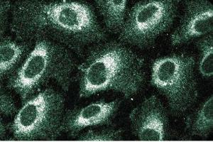 Immunofluorescent staining of Human Endothelial cells with anti-SRP54. (SRP54 抗体  (AA 262-476))