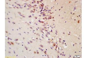 Formalin-fixed and paraffin embedded: rat brain tissue labeled with Anti-Tau protein Polyclonal Antibody , Unconjugated at 1:200 followed by conjugation to the secondary antibody and DAB staining (tau 抗体  (AA 681-758))