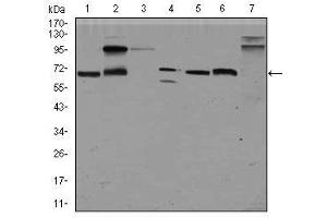 Image no. 5 for anti-Glypican 3 (GPC3) (AA 55-200) antibody (ABIN1498500)