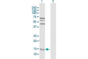 Western Blot analysis of PPIA expression in transfected 293T cell line by PPIA MaxPab polyclonal antibody. (PPIA 抗体  (AA 1-165))