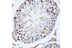 Immunohistochemistry of paraffin-embedded mouse testis using hnRNPM antibody (ABIN6128031, ABIN6141919, ABIN6141920 and ABIN6222681) at dilution of 1:100 (40x lens).