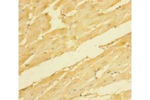 Immunohistochemistry of paraffin-embedded human heart tissue using ABIN7161234 at dilution of 1:100 (NRN1 抗体  (AA 28-116))