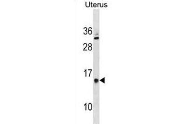 GALNTL5 antibody  (N-Term)