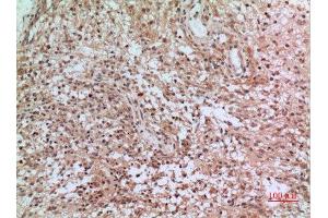 Immunohistochemistry (IHC) analysis of paraffin-embedded Human Brain, antibody was diluted at 1:100. (CD3D 抗体  (Internal Region))