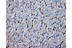 Immunohistochemical staining of paraffin-embedded liver tissue using anti-PSMC3mouse monoclonal antibody. (PSMC3 抗体)