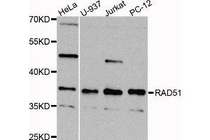 Western blot analysis of extracts of various cell lines, using RAD51 antibody (ABIN5973699) at 1/1000 dilution. (RAD51 抗体)