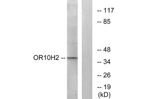 Western blot analysis of extracts from A549 cells, using OR10H2 antibody. (OR10H2 抗体  (C-Term))