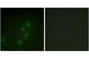 Immunofluorescence analysis of HeLa cells, using MYF5 (Ab-49) Antibody. (MYF5 抗体  (AA 21-70))