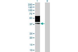 Western Blotting (WB) image for anti-Killer Cell Immunoglobulin-Like Receptor, Two Domains, Long Cytoplasmic Tail, 3 (KIR2DL3) (AA 1-341) antibody (ABIN517336)
