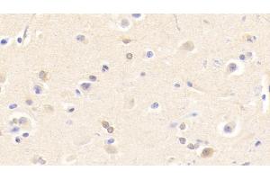 anti-Cholinergic Receptor, Nicotinic, beta 2 (Neuronal) (CHRNB2) (AA 86-244) antibody