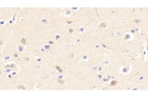 Detection of CHRNb2 in Human Cerebrum Tissue using Polyclonal Antibody to Cholinergic Receptor, Nicotinic, Beta 2 (CHRNb2) (CHRNB2 抗体  (AA 86-244))