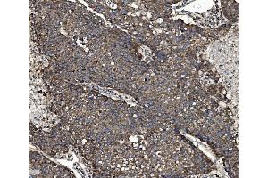 IHC analysis of NSF using anti-NSF antibody (ABIN7601630). (NSF 抗体  (AA 4-636))