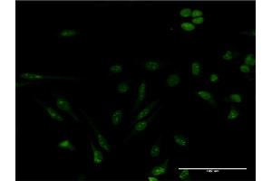 Immunofluorescence of monoclonal antibody to GEMIN4 on HeLa cell. (GEMIN4 抗体  (AA 959-1057))