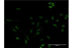 Immunofluorescence of monoclonal antibody to GEMIN4 on HeLa cell.