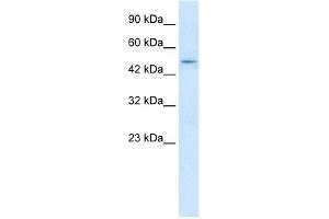 WB Suggested Anti-ZNF651 Antibody Titration:  2. (ZBTB47 抗体  (N-Term))