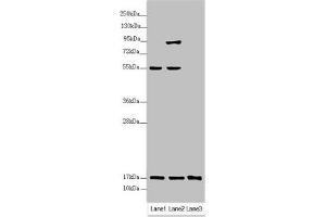 Western blot All lanes: UXT antibody at 3. (UXT 抗体  (AA 1-157))