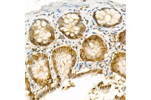 Immunohistochemistry of paraffin-embedded rat colon using [KO Validated] NADPH oxidase 4 (NOX4) Rabbit pAb (ABIN6128328, ABIN6144752, ABIN6144753 and ABIN6215143) at dilution of 1:100 (40x lens). (NADPH Oxidase 4 抗体  (AA 328-578))