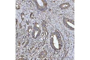 IHC analysis of COX5B using anti-COX5B antibody (ABIN7598975).