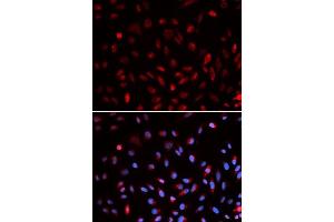 Immunofluorescence analysis of U2OS cells using ERCC1 antibody. (ERCC1 抗体  (AA 1-323))
