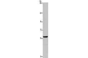Gel: 6 % SDS-PAGE, Lysate: 40 μg, Lane: Human fetal brain tissue, Primary antibody: ABIN7130066(LBR Antibody) at dilution 1/300, Secondary antibody: Goat anti rabbit IgG at 1/8000 dilution, Exposure time: 3 minutes (Lamin B Receptor 抗体)