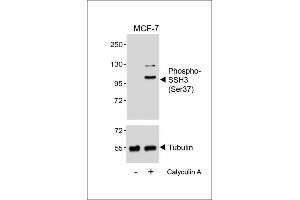 Western blot analysis of lysates from MCF-7 cell line, untreated or treated with Calyculin A, 100nM, using (ABIN6241058 and ABIN6578964) (upper) or Tubulin (lower). (SSH3 抗体  (pSer37))