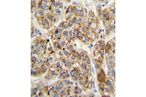Immunohistochemistry (IHC) image for anti-Methylcrotonoyl-CoA Carboxylase 2 (Beta) (MCCC2) antibody (ABIN3002883) (MCCC2 抗体)