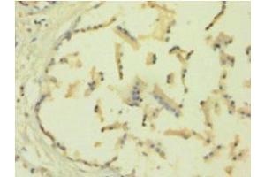 Immunohistochemistry of paraffin-embedded human plastate using TIMP1 Antibody at a dilution of 1:100. (TIMP1 抗体  (AA 24-207))