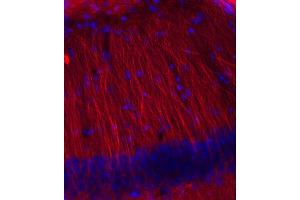 Immunohistochemistry (IHC) image for anti-Tubulin, beta 3 (TUBB3) (AA 443-450) antibody (ABIN1742554) (TUBB3 抗体  (AA 443-450))