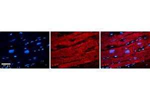 Immunohistochemistry (IHC) image for anti-Inhibitor of DNA Binding 1, Dominant Negative Helix-Loop-Helix Protein (ID1) (Middle Region) antibody (ABIN5516062)