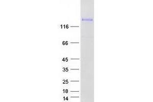 Western Blotting (WB) image for LIM and Calponin Homology Domains 1 (LIMCH1) (Transcript Variant 1) protein (Myc-DYKDDDDK Tag) (ABIN2724729)