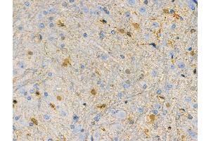 ABIN6262093 and ABIN6268791 at 1/100 staining Rat brain tissue by IHC-P. (Metabotropic Glutamate Receptor 5 抗体  (N-Term))