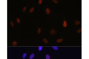 Immunofluorescence analysis of U-2 OS cells using MonoMethyl-Histone H3-K14 Polyclonal Antibody at dilution of 1:100 (40x lens).