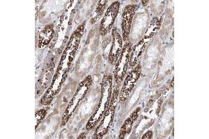 Immunohistochemical staining (Formalin-fixed paraffin-embedded sections) of human kidney shows strong cytoplasmic positivity in distal tubules. (MAD2L1 抗体)