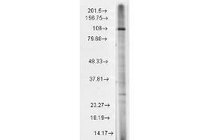 Western Blot analysis of Rat brain membrane lysate showing detection of TrpC7 protein using Mouse Anti-TrpC7 Monoclonal Antibody, Clone S64A-36 . (TRPC7 抗体  (AA 845-862) (HRP))