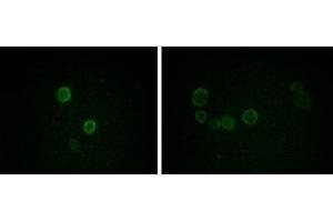 Immunofluorescence analysis of methanol-fixed L-02 (left) and Cos7 (right) cells using ApoM mouse mAb showing cytoplasmic and membrane localization. (Apolipoprotein M 抗体)