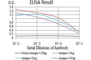 Black line: Control Antigen (100 ng);Purple line: Antigen (10ng); Blue line: Antigen (50 ng); Red line:Antigen (100 ng) (ZFP91 抗体  (AA 162-304))