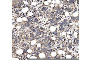 IHC analysis of QSOX2 using anti-QSOX2 antibody (ABIN7599640).