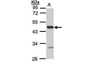 WB Image Sample(30 ug whole cell lysate) A:293T 10% SDS PAGE antibody diluted at 1:1000 (UST 抗体)
