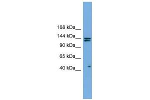 IARS antibody used at 1 ug/ml to detect target protein. (IARS 抗体  (Middle Region))