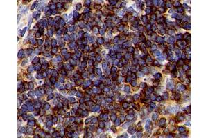 Immunohistochemistry analysis of paraffin-embedded Mouse spleen using CD192 Polyclonal Antibody at dilution of 1:300. (CCR2 抗体)