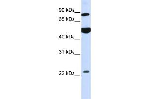 Western Blotting (WB) image for anti-Mannosyl-Oligosaccharide Glucosidase (MOGS) antibody (ABIN2459038) (GCS1 抗体)
