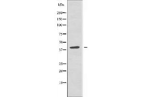 Western blot analysis of extracts from Jurkat cells, using RAD51L3 antibody. (RAD51D 抗体  (C-Term))
