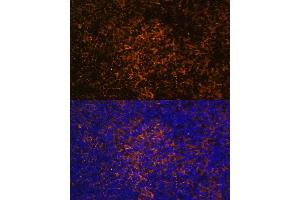 Immunofluorescence analysis of rat thymus using ICOS/CD278 antibody (ABIN3022590, ABIN3022591, ABIN3022592, ABIN1513055 and ABIN6218929) at dilution of 1:100.