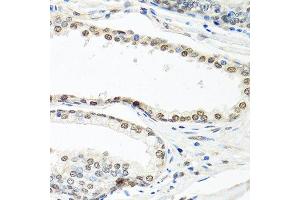 Immunohistochemistry of paraffin-embedded human prostate using ELAVL1 antibody. (ELAVL1 抗体  (AA 1-100))