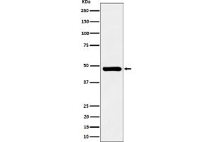 Western blot analysis of SNX5 expression in Jurkat cell lysate.