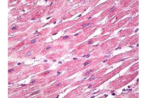 Anti-EPM2A / Laforin antibody IHC of human heart.