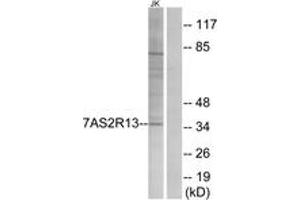 Western blot analysis of extracts from Jurkat cells, using TAS2R13 Antibody. (TAS2R13 抗体  (AA 123-172))